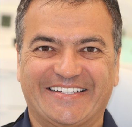 After — CDCP smile restoration